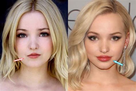 Dove Cameron Before And After 2020