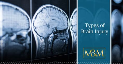 What Are The Types Of Brain Injury Mbm Justice Providence