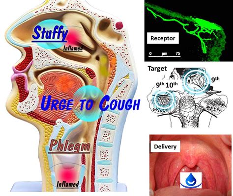Cool Esthesia Airway Hygiene Stop Stuffiness Cough And Clear Phlegm