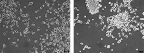 B35 Neuroblastoma Cells Under Light Microscopy Before And After