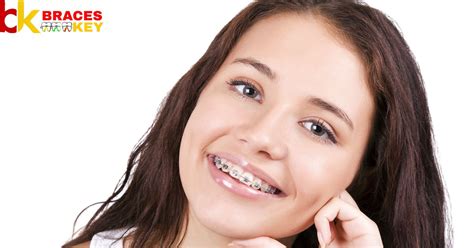 What Happens If You Lose Insurance During Braces Braces Key
