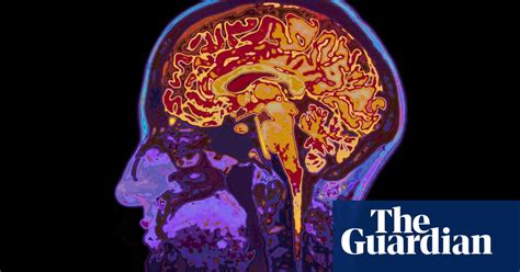 forget stereotypes how to recruit talented neurodiverse employees guardian small business