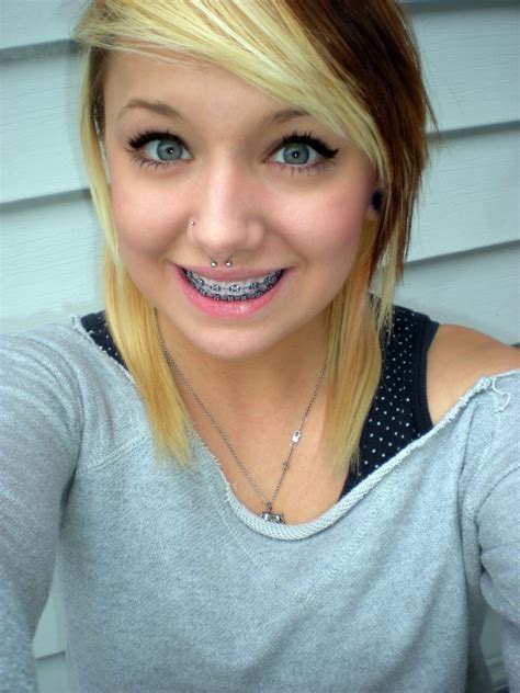 Girls With Braces On Twitter Check Out Her Awesome Metal Braces