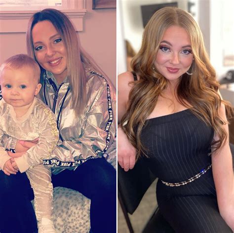 Teen Mom Stars Plastic Surgery Before And After Photos