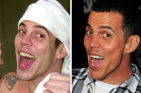 Imho, davis has the potential to one day be among the league leaders. steve-o before and after