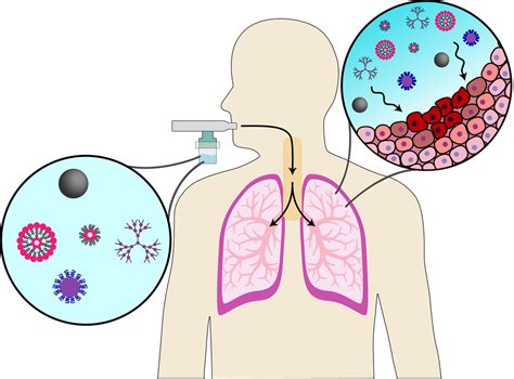 Inhalable nanotherapeutics to improve treatment efficacy for common