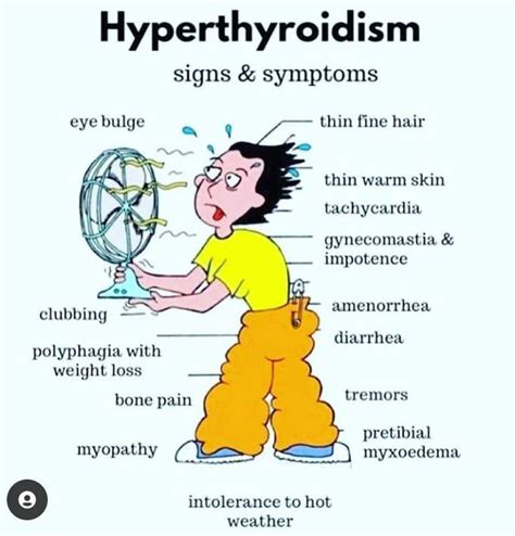 Hyperthyroidism Medizzy