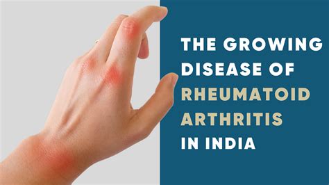 The Growing Disease Of Rheumatoid Arthritis In India By Aadar Medium