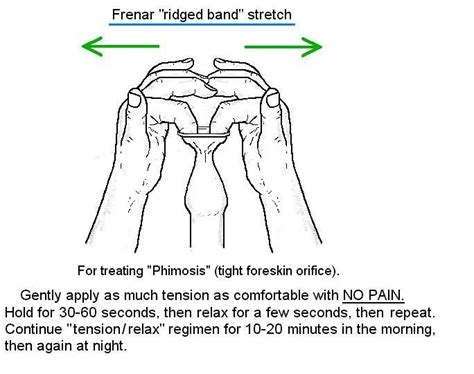 Tight Foreskin Or Short Frenulum Penis Disorders Mens Health