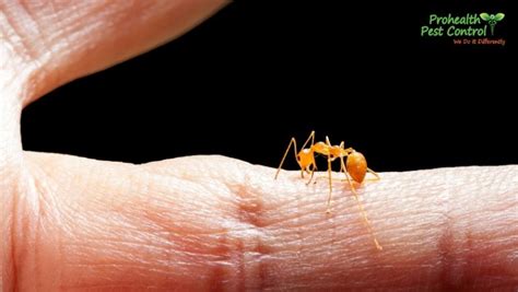 How To Treat An Ant Bite Properly And Safely Before An Infection