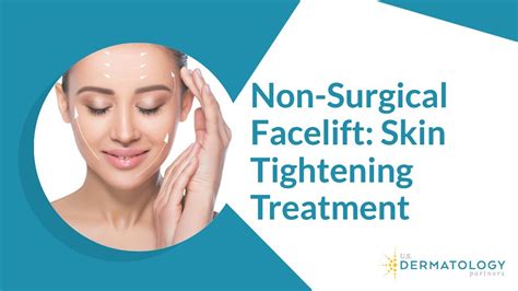 Non Surgical Facelift Skin Tightening Treatment Youtube