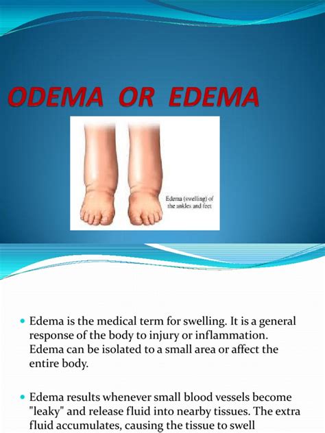 Odema Or Edema Pdf Edema Health Sciences
