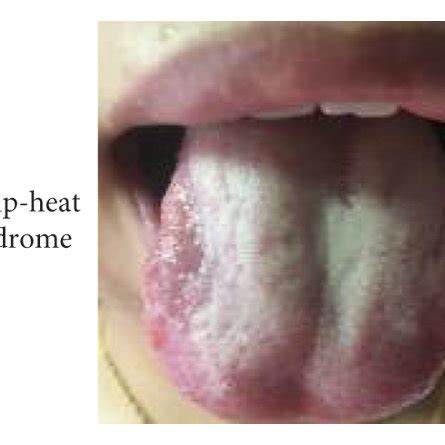 TCM Tongue Coating Appearance Classification A B Typical