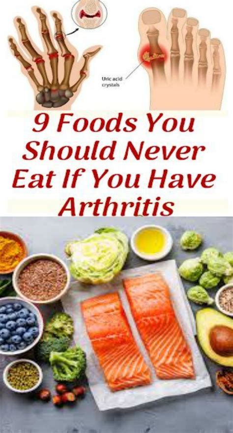 9 Foods You Should Never Eat If You Have Arthritis Food Healthy