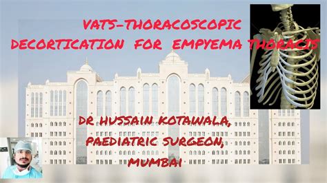 Vatsvideo Assisted Thoracoscopic Surgery Decortication For Empyema