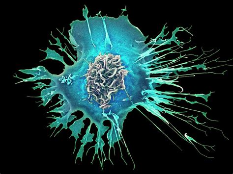 Human Dendritic Cell Photograph By Dennis Kunkel Microscopyscience