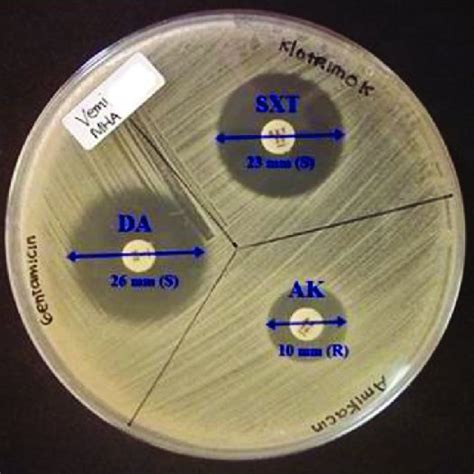 Methicillin Resistant Staphylococcus Aureus Mrsa Confirmation Test On