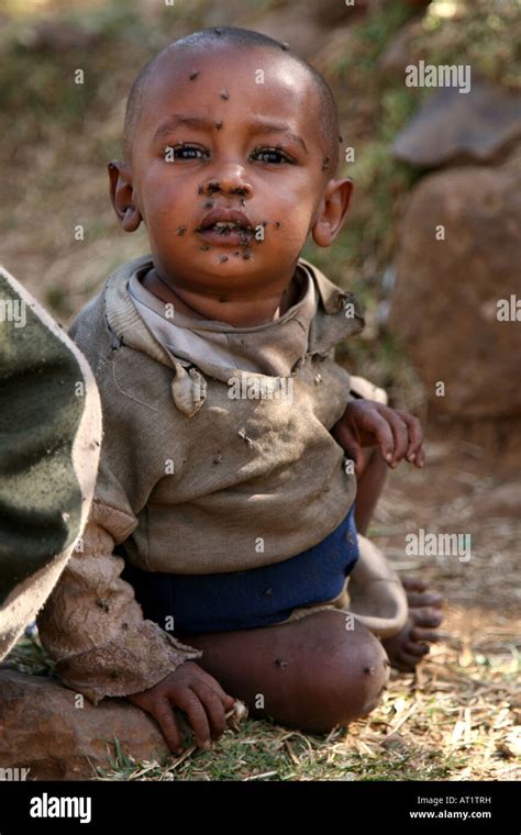 Young African Boy With Flies On His Face In Ethiopia Stock Photo Alamy