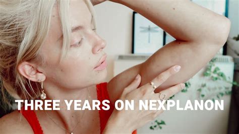 3 YEARS On The Contraceptive Implant Implanon Nexplanon My Birth
