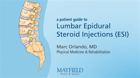 Lumbar Epidural Steroid Injection Youtube