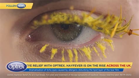 Natural eyewash is very famous for the treatment of itchy eyes. Treat your Itchy & Watery Eyes with Optrex - YouTube