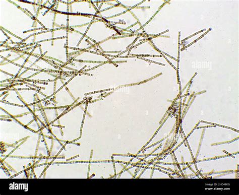 Nodularia Algae Under Microscopic View Nitrogen Fixing Cyanobacteria