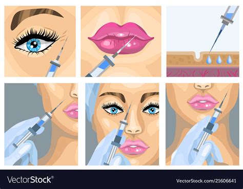 Botox Injection Cosmetic Procedure Set Royalty Free Vector