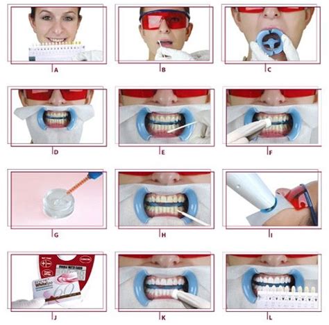 The 25 Best Teeth Whitening Procedure Ideas On Pinterest Homemade