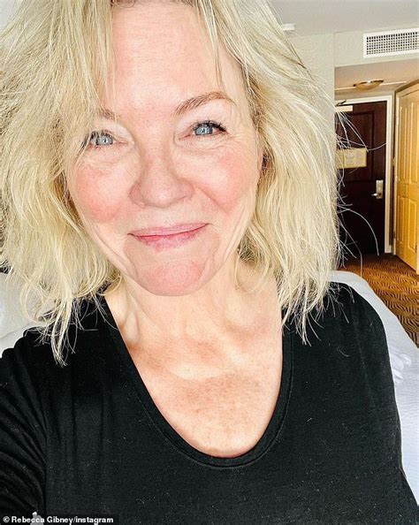 Rebecca Gibney Shocks As The Beloved Actress Shares Confronting Image Of Black Eye Following