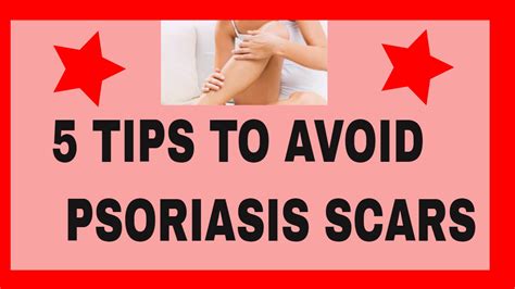 5 Tips To Avoid Psoriasis Scars Youtube