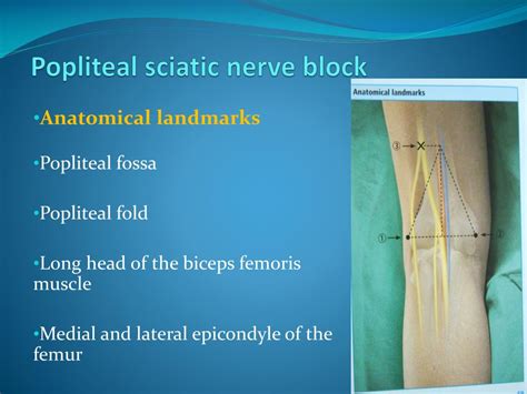 Ppt Peripheral Nerve Blocks Using Nerve Stimulator Powerpoint