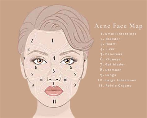 Face Mapping What Do Your Breakouts Actually Mean