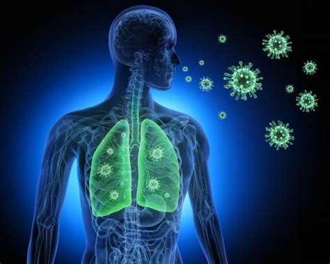 Lungenentzündung Pneumonie Symptome Behandlung Verlauf