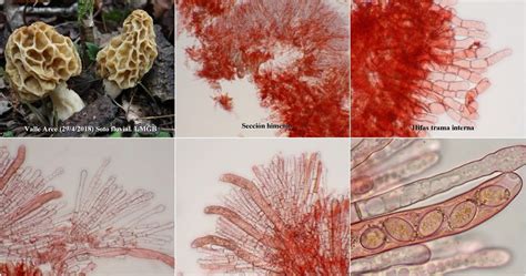 Microscopía de hongos. Vol 3. L - N: Morchella fluvialis
