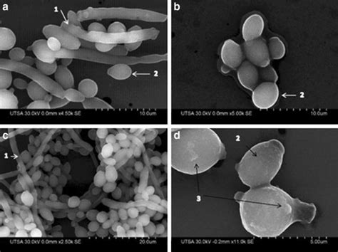 Sem Images Of Biofilm Formation Of Candida Albicans Inhibited With