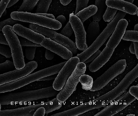 Escherichia Coli Bacteria — Science Learning Hub