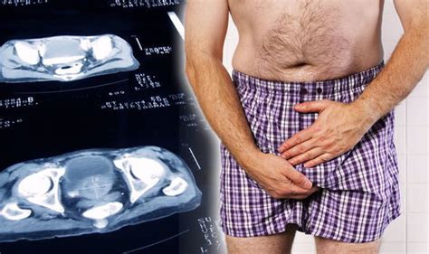 We did not find results for: You Can See More: Prostate cancer symptoms: Do you have ...