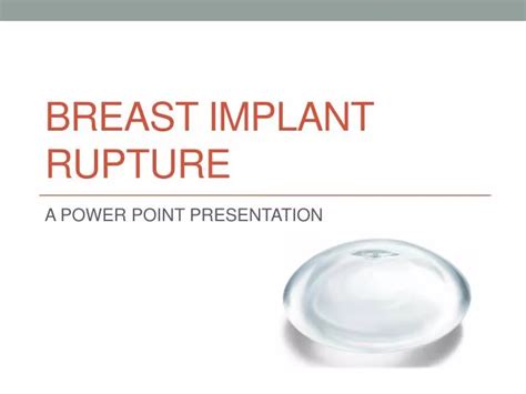 Ppt Breast Implant Rupture Powerpoint Presentation Free Download