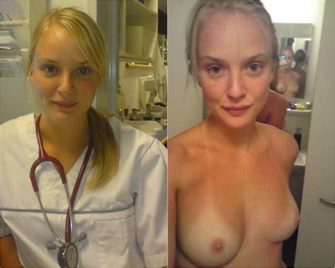Nurse Before And After Nudes Xxx Porn