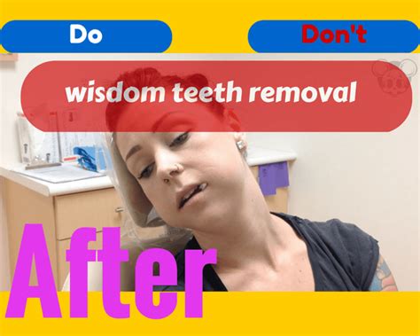 After Wisdom Teeth Removal Recovery Tips Foods Pain Relief Extraction