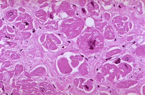 .acta anatomica, american journal of anatomy, archiv fur mikroskopische anatomie, archives d'anatomie microscopique et de morphologie, archivos de histologia normal у patologica. Cardiovascular Pathology