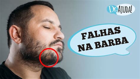 3 Principais Causas De Falhas Na Barba E O Que Fazer Para A Barba Crescer Youtube