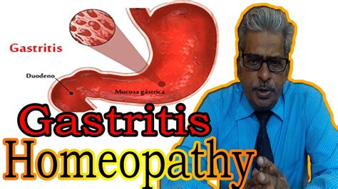 Gastritis In Hindi Discussion And Treatment In Homeopathy By Dr Ps