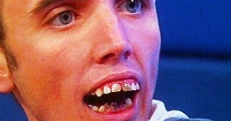 British Bad Teeth