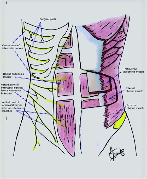 Overview Of Rectus Abdominis Muscle And Nerve Supply The Rectus My