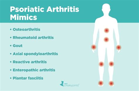 Psoriatic Arthritis Misdiagnosis Diseases Psa Can Be Mistaken For