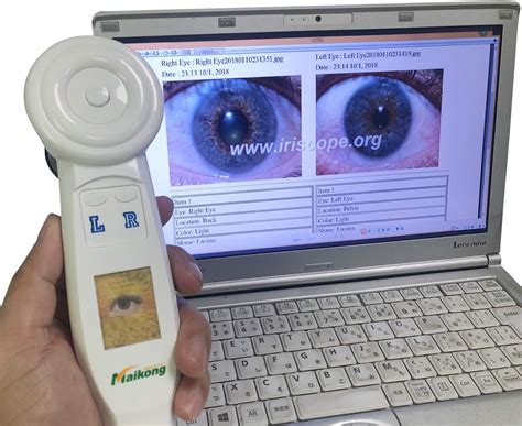 maikong Cámara de iridología caliente 2022 USB Iriscope Iris Analizador