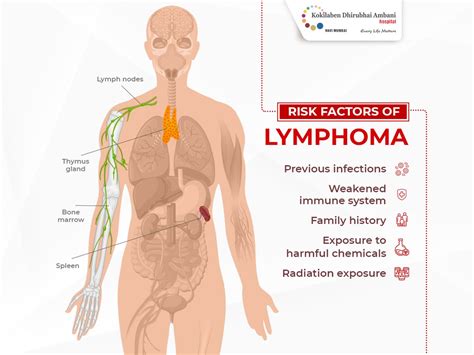 Risk Factors Of Lymphoma