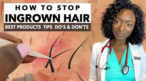 How To Stop Ingrown Hair And Razor Bumps From Waxing And Shaving