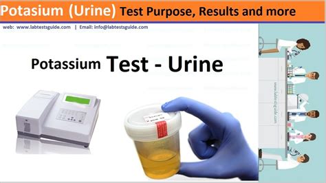 Potassium Urine Test Causes Purpose Overview And More Lab Tests Guide